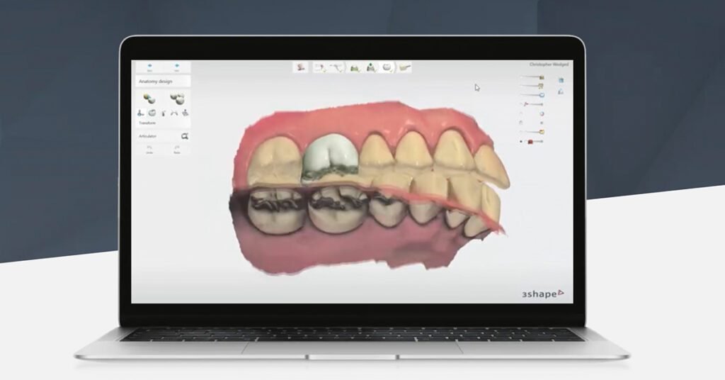 3Shape Trios | CADCAM Systems | Dental Resource Asia