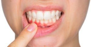 New tech for early detection of gum disease | Dental Resource Asia