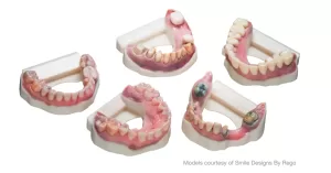 Stratasys and 3Shape announce new automated 3D printing colour workflow_Dental Resource Asia