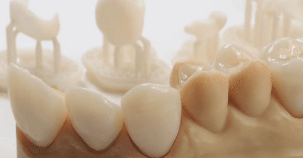 Essential Guide to Dental 3D Printing_3D Printed Crowns_Dental Resource Asia