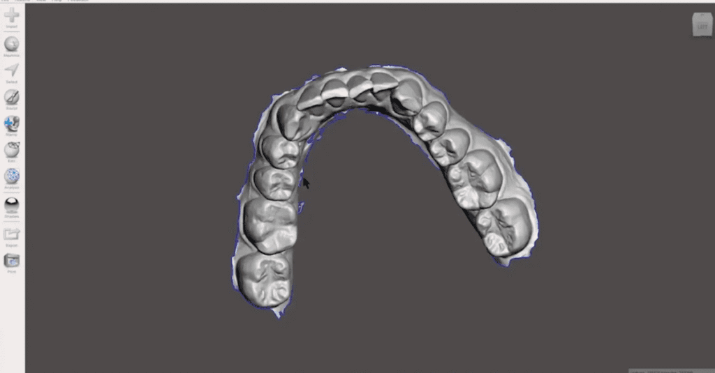 Essential Guide to Dental 3D Printing_3D Printing CAD software_Dental Resource Asia