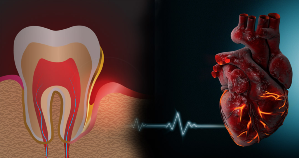 oral-bacteria-may-increase-heart-disease-risk-pharmatutor