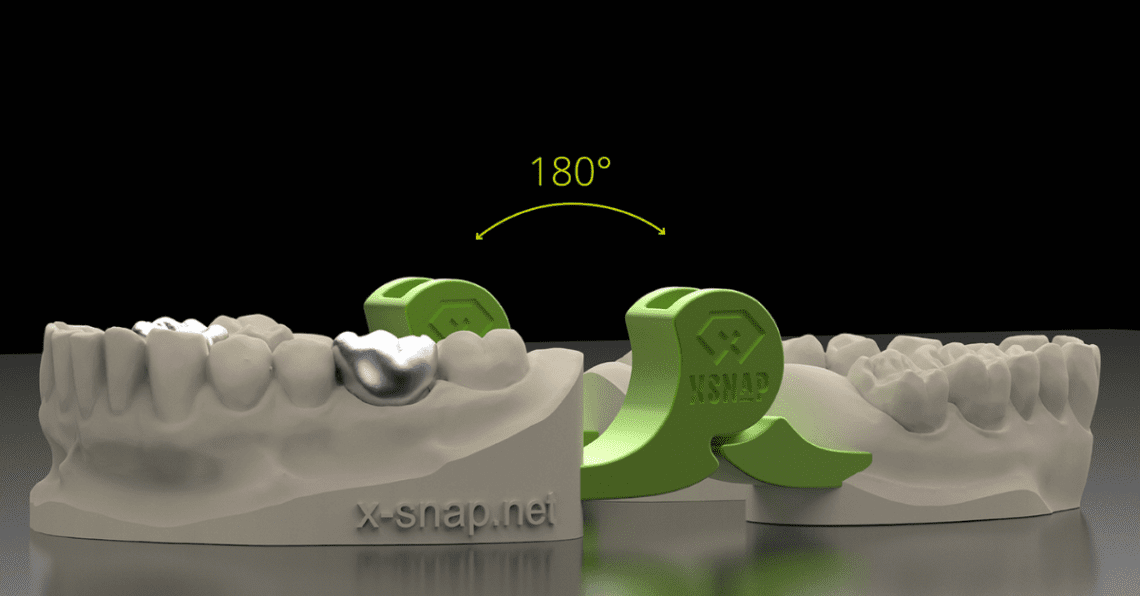 exocad Launches xSNAP for Printable Articulators DENTAL RESOURCE ASIA