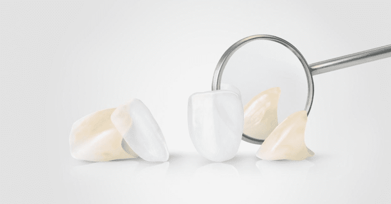 Lithoz Unveils 3D-Printed Lithium Disilicate Restorations at IDS 2023_Dental Resource Asia