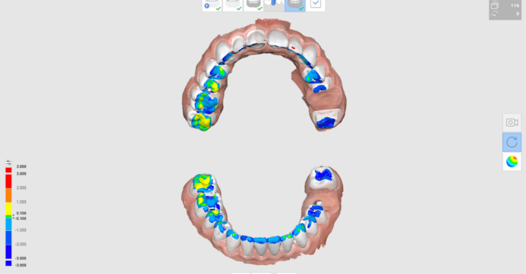 Medit Occlusion Analyser_Dental Resource Asia