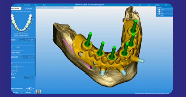 ZimVie Launches RealGUIDE CAD and FULL SUITE Software_Dental Resource Asia