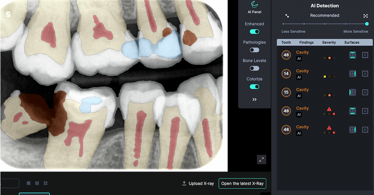 Explore Adravision’s AI Dental X-ray Software For Enhancing Clinical ...