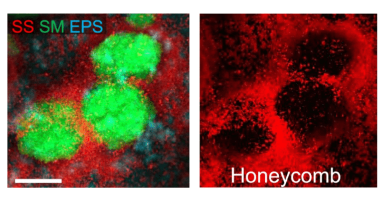 Collaborative Research Reveals Surprising Bacterial Species Linked to Tooth Decay_Dental Resource Asia