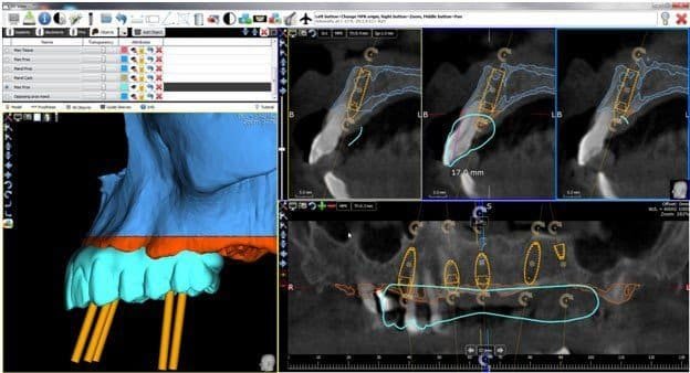 Cone-Beam-CT_Dental Resource Asia