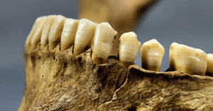 Tooth Analysis Reveal Longer Breastfeeding Among Middle Ages Bavarians_Dental Resource Asia