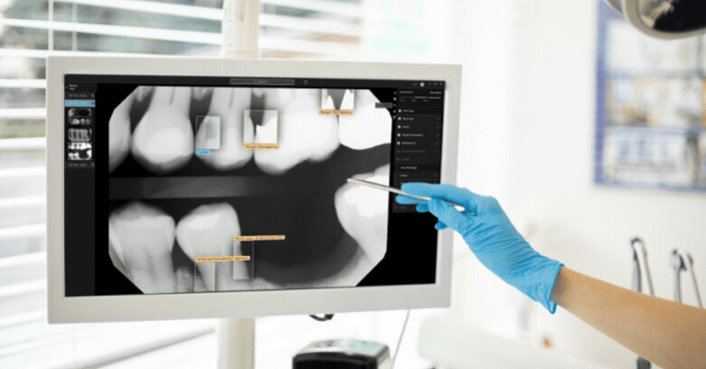 Second-Opinion-please_Artificial-intelligence-assisted-radiology-tool_Dental Resource Asia