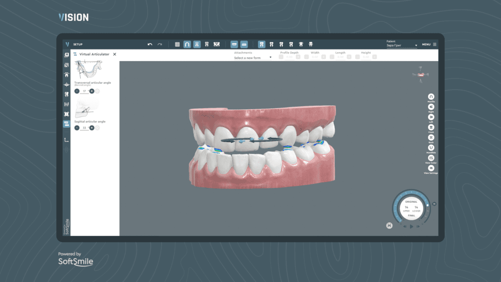 Softsmile Virtual Articulator_Dental Resource Asia