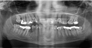 Patient Awarded £11,500 in Settlement After Dental Nightmare_Dental Resource Asia